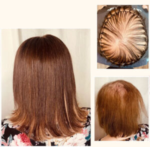 Engrosamiento del cabello con coloración